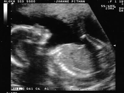 Isla Debra Pitman Isla Debra Pitman