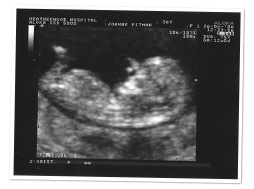 Baby Pitman #3.